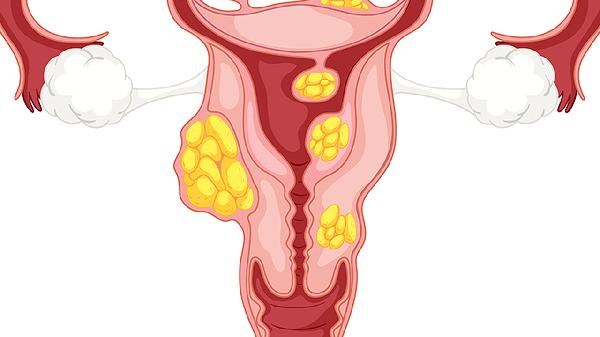 21个月宝宝腹泻：原因、症状与应对措施